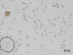 Diplocarpon_fragariae_6