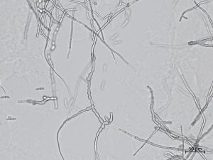 Fusarium_sambucinum_8