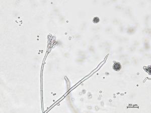 Penicillium_olsonii_7