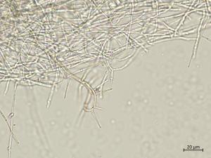 Phaeoacremonium_minimum_8