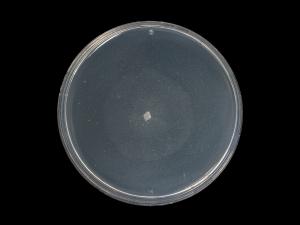 Phytophthora_erythroseptica_3