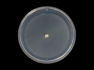 Plectosphaerella_cucumerina_10