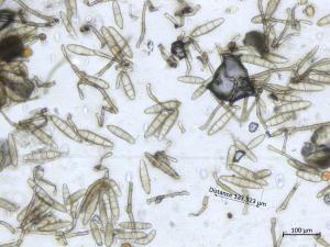 Exserohilum_turcicum_2