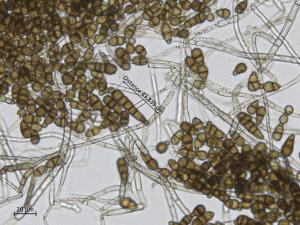 Alternaria_brassicicola_3