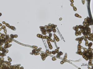 Alternaria_brassicicola_4