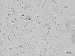 Cadophora_luteo-olivacea_8