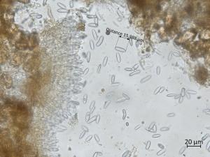 Colletotrichum_sp_2