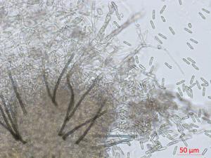 Colletotrichum_sp_3