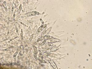 Colletotrichum_gloeosporioides_3
