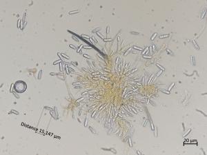 Colletotrichum_sp_7