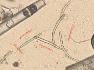 Corynespora_cassiicola_1