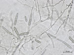 Corynespora_cassiicola_2
