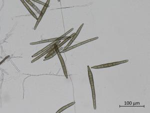 Corynespora_cassiicola_3