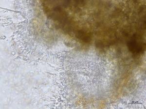 Cytospora_chrysosperma_1