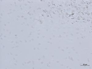 Cytospora_chrysosperma_2