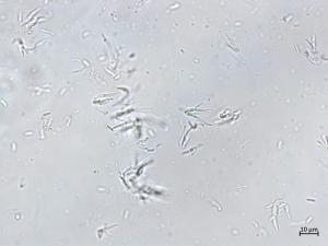 Cytospora_sp_2