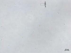 Cytospora_chrysosperma_3