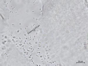 Cytospora_sp_5