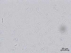 Diaporthe_caulivora_3