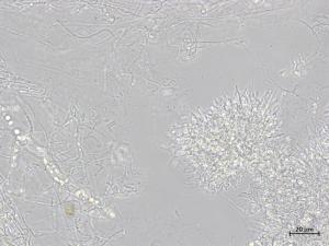 Diaporthe_caulivora_1