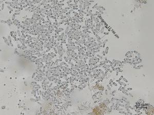 Diaporthe_humulicola_1