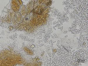 Diaporthe_humulicola_2