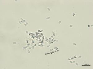 Diaporthe_vaccinii_3