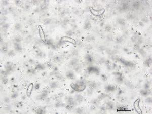 Drepanopeziza_ribis_4