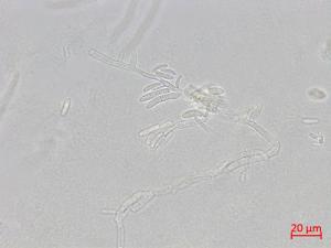 Fusarium_proliferatum_1