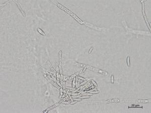 Fusarium_sporotrichioides_1