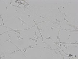Fusarium_sporotrichioides_2