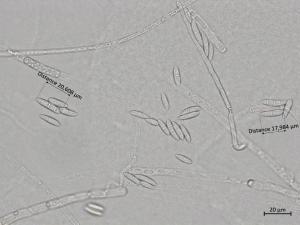 Fusarium_sporotrichioides_3
