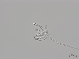 Fusarium_sporotrichioides_4