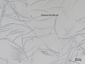 Fusarium_tricinctum_2