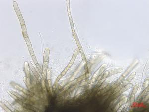 Graminopassalora_graminis_1