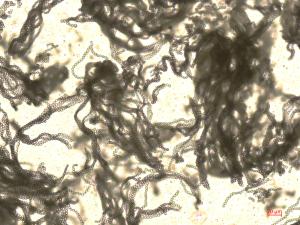 Penicillium_expansum_2