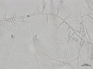 Phaeoacremonium_fraxinopennsylvanicum_3