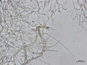 Phaeoacremonium_fraxinopennsylvanicum_1