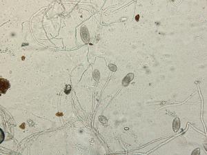 Phytophthora_infestans_6