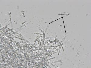 Cadophora_luteo-olivacea_9