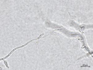 Neocosmospora_phaseoli_6