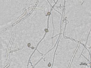 Neocosmospora_phaseoli_7