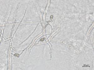 Neocosmospora_phaseoli_8
