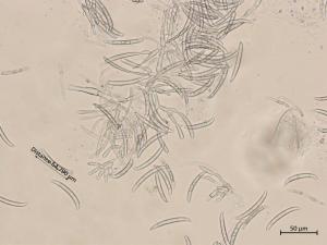 Neocosmospora_phaseoli_9
