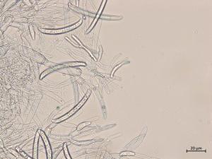 Neocosmospora_phaseoli_11