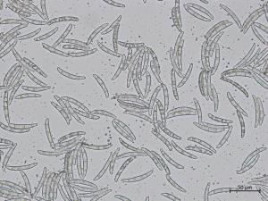 Thelonectria_veuillotiana_1