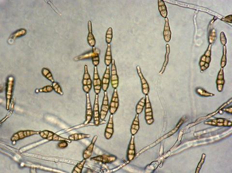 Alternaria_alternata-02_LQ