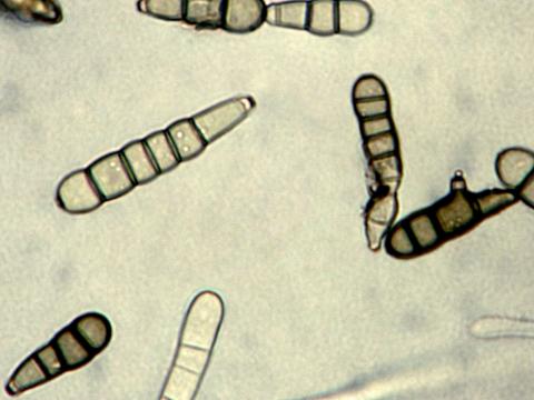 Alternaria_brassicicola-08_LQ