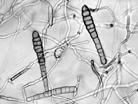 Alternaria_chrysanthemi-03_LQ