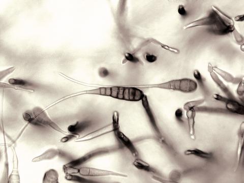 Alternaria_cichorii-10_LQ